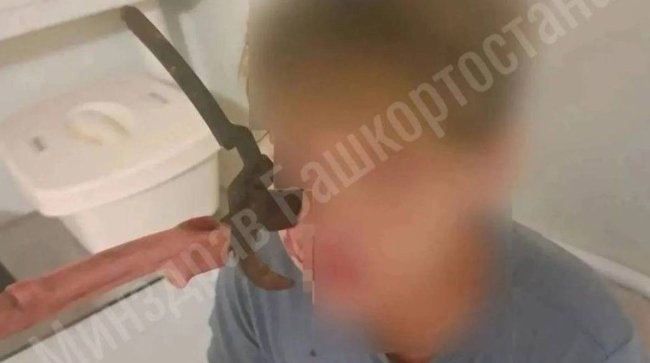 Секатор вонзился в лицо подростку во время игры с братом в Башкирии - «Новости»